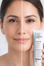 NIDA® Crema Hidratante Anti-Edad Coreana, empieza a cuidar tu piel desde hoy !!!