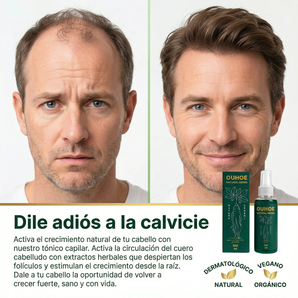 Elixir capilar anticaída y crecimiento OUHOE Natural Herbs, 50% de descuento, inicia tu tratamiento capilar ahora