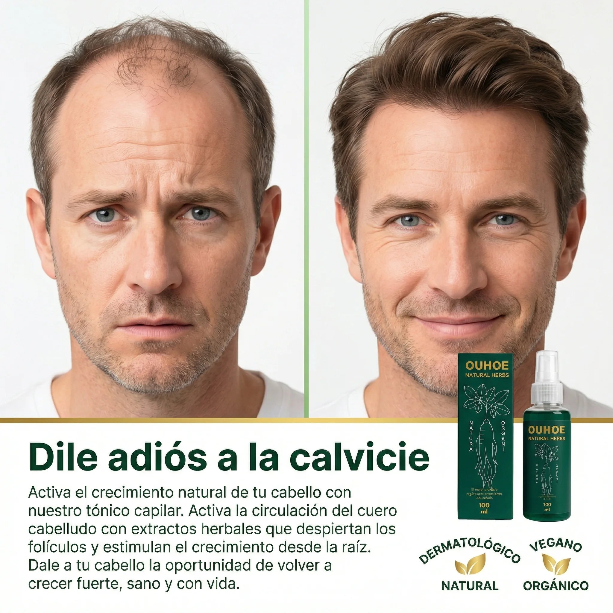 Elixir capilar anticaída y crecimiento OUHOE Natural Herbs, 50% de descuento, inicia tu tratamiento capilar ahora