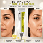 Retinal Shot Tightening Booster: Reafirma e ilumina tu Piel al Instante