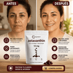 Astaxanthin 12 mg de Microingredients®  Cuida tu piel y riñones  desde hoy con protección antioxidante avanzada